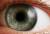 科學家在眼球內發現新的人體組成，能夠改善角膜移植手效果